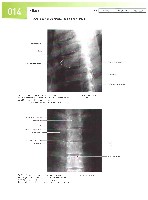 Sobotta  Atlas of Human Anatomy  Trunk, Viscera,Lower Limb Volume2 2006, page 21